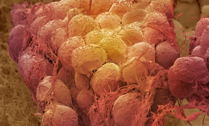 Men’s and women’s body fat standards