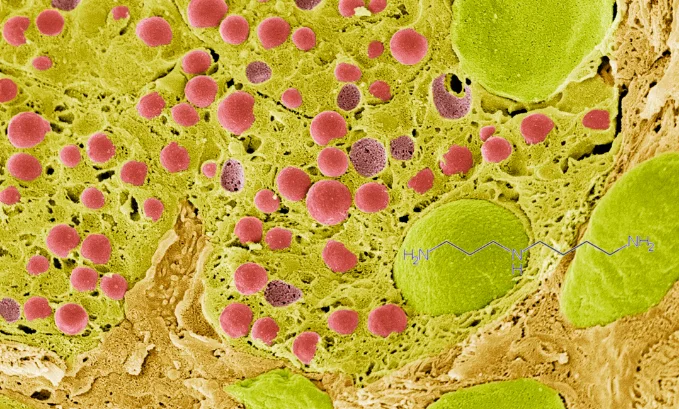 Spermidine and Autophagy
