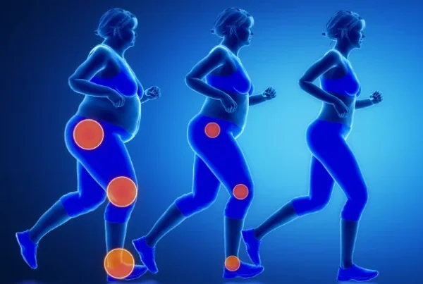 retatrutide for obesity