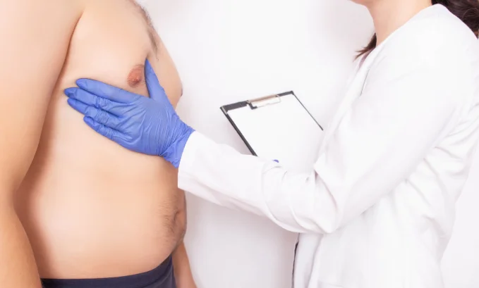 selective estrogen receptor modulator