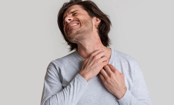 skin pain semaglutide