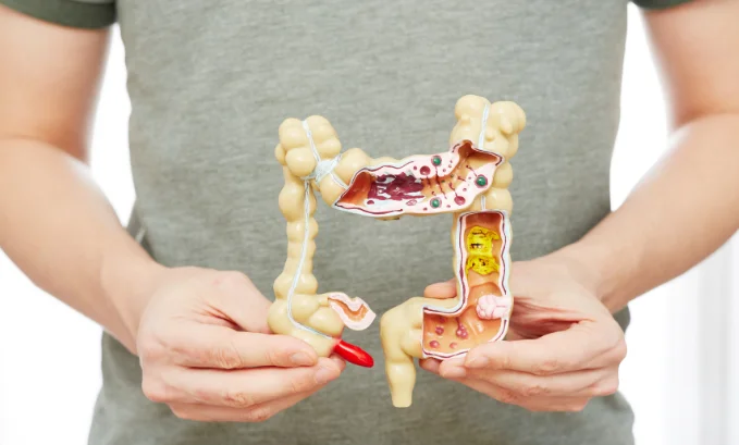 can semaglutide cause constipation 